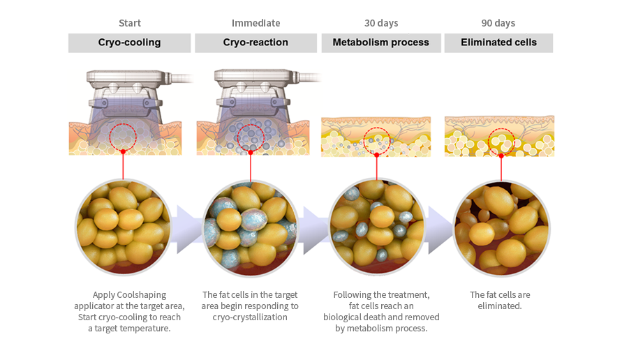 Jackie Beauty in Cherrybrook, Sydney, where style meets care. I’m Jackie, a qualified hairdresser and colour specialist with experience across the UK and Australia. Enjoy tailored hair and beauty services.