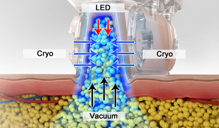 Jackie Beauty in Cherrybrook, Sydney, where style meets care. I’m Jackie, a qualified hairdresser and colour specialist with experience across the UK and Australia. Enjoy tailored hair and beauty services.