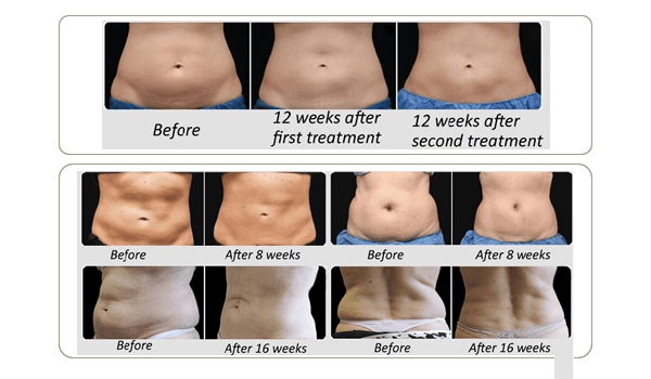 My name is Jackie, and I bring over 23 years of professional expertise and creativity to the vibrant and evolving world of hairdressing and beauty. As a dedicated Goldwell color specialist and an exceptionally qualified hairdresser, my journey into this fascinating industry began with extensive and rigorous training at the prestigious TONI & GUY academy in Manchester, UK. This foundational experience was further enriched by opportunities to work in diverse environments, which allowed me to gain additional invaluable insights and skills in countries such as Iran, Turkey, and Australia. Throughout my career, I have continuously honed my craft, always striving to provide my clients with the highest standard of service and innovative hair solutions.